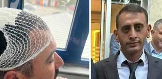 Belediye başkan yardımcısına şekerlikle saldıran Yeniden Refah Partili tutuklandı