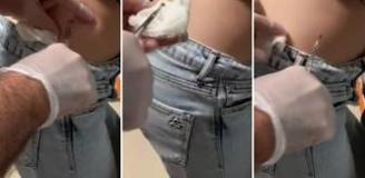 Talihsiz kadının korku dolu anları! Sivilce sandı ama yakından bakınca hastaneye koştu