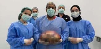 Şişlik yüzünden gitti, karnından çıkan doktorları bile şoke etti