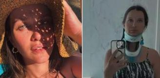 İrem Helvacıoğlu tatilde kaza geçirdi: Felç kaldım sandım
