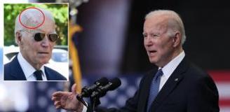 Eski ABD Başkanı Joe Biden cilt kanseri ameliyatı oldu