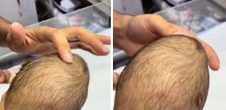 Yeni doğan bebeğin bıngıldağına basan doktorun gördüğü manzara korkunç