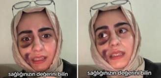 Stajyer doktora tedavi olan kadın video çekip isyan etti