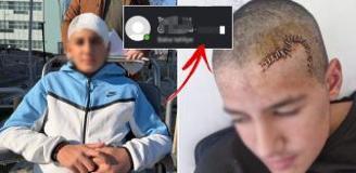 Okul arkadaşı taşla kafasını parçaladı! Tahliye edilen çocuğun paylaşımı çıldırttı