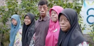 Dünya onları konuşuyor! 'Kertenkele Ailesi' kısa sürede fenomen oldu