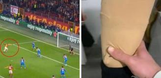 Barış Alper'e kızıp anneannesinin protez ayağını söktü