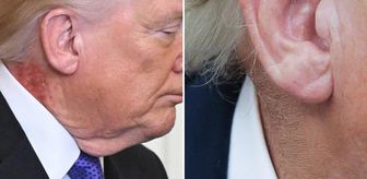 Trump'ın boynundaki kızarıklığı gizleme çabası