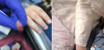 AVM'de yürüyen merdivene eli sıkışan çocuğun parmağı koptu
