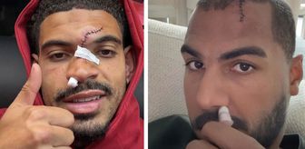 Kafa kafaya çarpışan Morgan Gibbs-White ve Robert Sanchez'in yüzünün son durumu korkuttu
