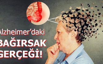 Alzheimer'daki bağırsak gerçeği!