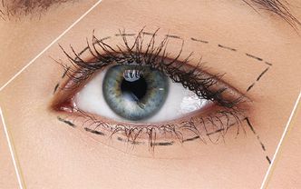 Bella Eyes mı, blefaroplasti mi? Göz estetiğinde karar anı