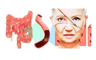Bağırsak Geçirgenliği (Leaky Gut), Sistemik İnflamasyon ve Cilt Sağlığı