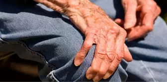 Parkinson Gençleri de Etkiliyor