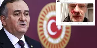 MHP'li Grup Başkanvekili Erkan Akçay, darp edilen yazarın fotoğrafını paylaştı