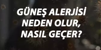 Güneş Alerjisi Nedir, Neden Olur ve Nasıl Geçer? Güneş Alerjisi Belirtileri ve Tedavisi Hakkında Bilgi