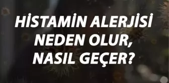 Histamin Alerjisi Nedir, Neden Olur ve Nasıl Geçer? Histamin Alerjisi Belirtileri ve Tedavisi Hakkında Bilgi