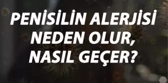 Penisilin Alerjisi Nedir, Neden Olur ve Nasıl Geçer? Penisilin Antibiyotik Alerjisi Belirtileri ve Tedavisi Hakkında Bilgi