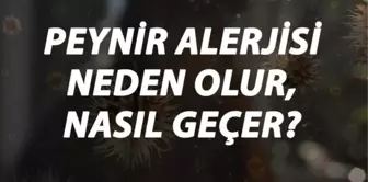 Peynir Alerjisi Nedir, Neden Olur ve Nasıl Geçer? Peynir Alerjisi Belirtileri ve Tedavisi Hakkında Bilgi