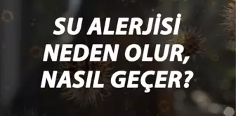 Su Alerjisi Nedir, Neden Olur ve Nasıl Geçer? Su Alerjisi Belirtileri ve Tedavisi Hakkında Bilgi