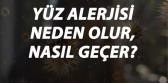 Yüz Alerjisi Nedir, Neden Olur ve Nasıl Geçer? Yüz Alerjisi Belirtileri ve Tedavisi Hakkında Bilgi