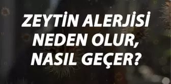 Zeytin Alerjisi Nedir, Neden Olur ve Nasıl Geçer? Zeytin Alerjisi Belirtileri ve Tedavisi Hakkında Bilgi