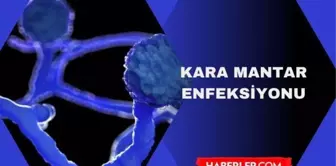 Kara mantar hastalığı bulaşıcı mı? Kara mantar enfeksiyonu nedir? Kara mantar hastalığı nasıl bulaşır?