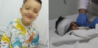 The little boy was seriously injured in an attack by street dogs.