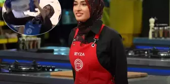 MasterChef Beyza shared a photo of her burned face with the note 