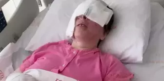 The woman who had acid thrown on her face: I cry every day, blood comes from my eyes.