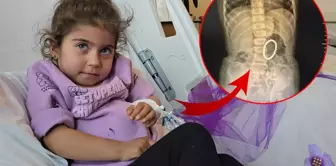 The things that came out of the 4-year-old child's intestines shocked everyone, 