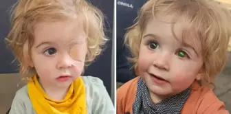 A 2-year-old child lost an eye because of a kiss.