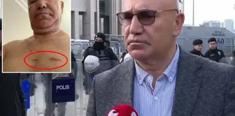 CHP member Tanal shared the scars on his body during the protest demonstration.