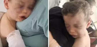 Aren bebeği, annesinin sevgilisi tarafından öldüresiye darbedildikten sonra yakmaya çalışmışlar. 

Arapça tercümesi:
حاولوا إحراق الطفل أرن بعد أن تعرض للضرب المبرح من قبل حبيب والدته.