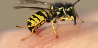 The young woman who was stung by a bee has passed away.