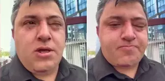 Serious allegation: Altındağ Mayor Tiryaki assaulted a municipal worker.