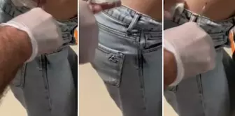 The unfortunate woman's moments of terror! She thought it was a pimple, but when she realized the truth, she rushed to the hospital.