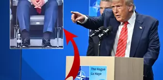 The swelling in his legs had drawn attention! The White House announced the illness that Trump had contracted.