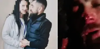 The horror of forbidden love! The family of the ex-lover tortured and mutilated him.