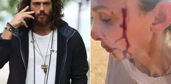 Can Yaman's girlfriend, Sara Bluma, announced that she has experienced violence.