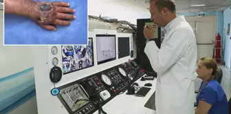 Even the doctors were surprised! The thief bit his hand so badly that the case is about to enter the literature.