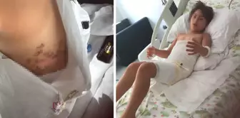 Gittikleri düğün felaketi oldu! Vücudunun yüzde 16'sı dondu. 

На свадьбе, на которую они пошли, произошла катастрофа! 16% его тела замерзло.