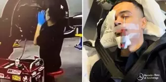 Scary accident in car repair! A screwdriver got stuck in the worker's eye.