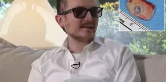 The tooth in his mouth got stuck in his eye, and he was freed from blindness after 20 years.