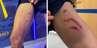 The current state of the Fenerbahçe star who was kicked during the Stuttgart match is incredible.