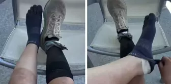 The condition of the runner's feet after running 160 kilometers is incredible.