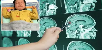 Breakthrough step! Brain damage can now be detected early.