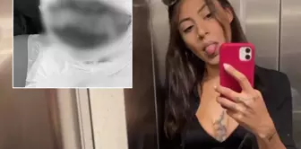 A woman was set on fire in a luxury neighborhood of Istanbul! She asked a single question and then lit the match.