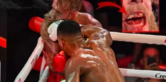 عاش كابوس الجولة السادسة! إليكم الحالة الأخيرة لجايك بول بعد كسر فكه.