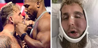 سوف تصدمون عندما تعرفون كم ربح جيك بول بعد أن أصبح وجهه غير قابل للتعرف.