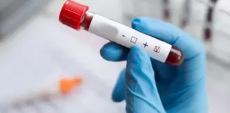 Cases are decreasing worldwide, while HIV is increasing in Turkey.